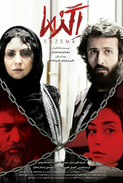 اگزما